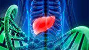 Four Genes Linked to Cystic Diseases of the Liver and Kidney