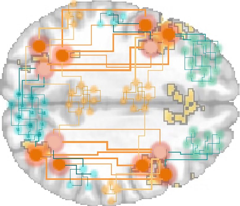 Frontoparietal Cortex Tracking Uncertainty