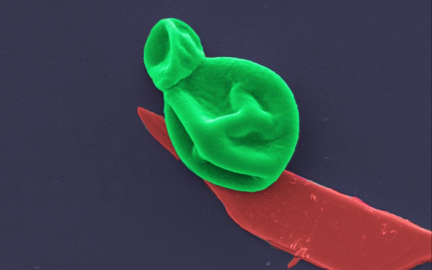 New Nanotech destroys bacteria and fungal cells, leaving human cells unharmed