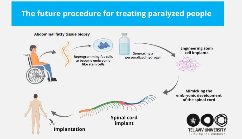 Future of Treating Paralyzed People