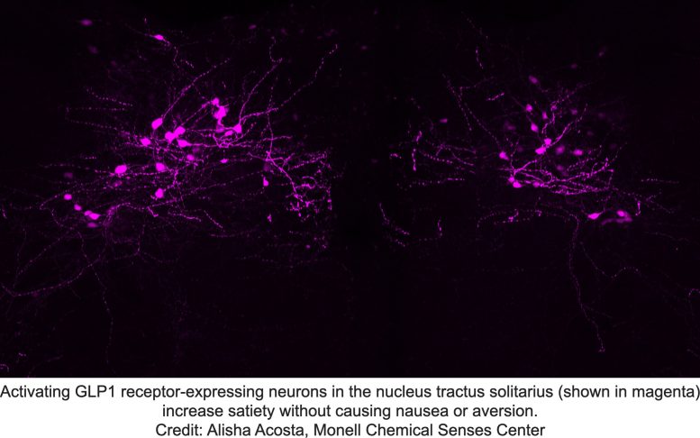 GLP1 Receptor Expressing Neurons