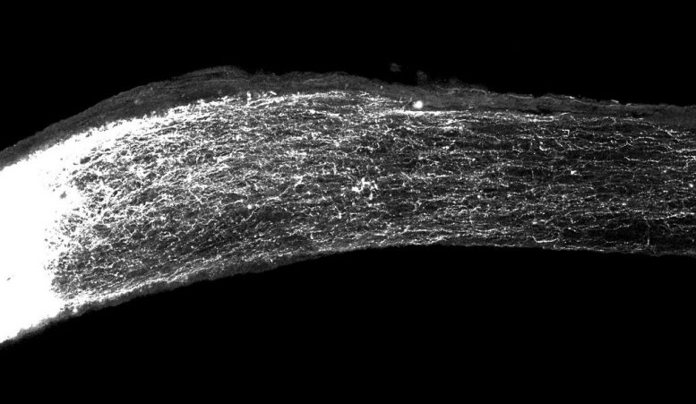 Gene Spurs Regeneration of Damaged Nerve Cells
