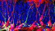 Generate New Neurons in Brain