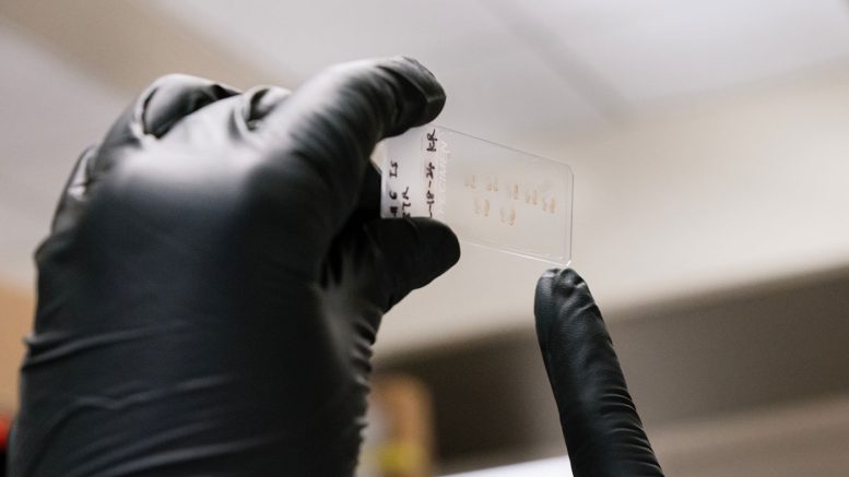 Gladstone Institute Researcher Examining a Laboratory Microscope Slide