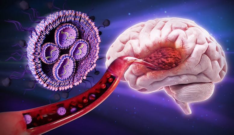 Glioblastoma Nanomedicine Graphic