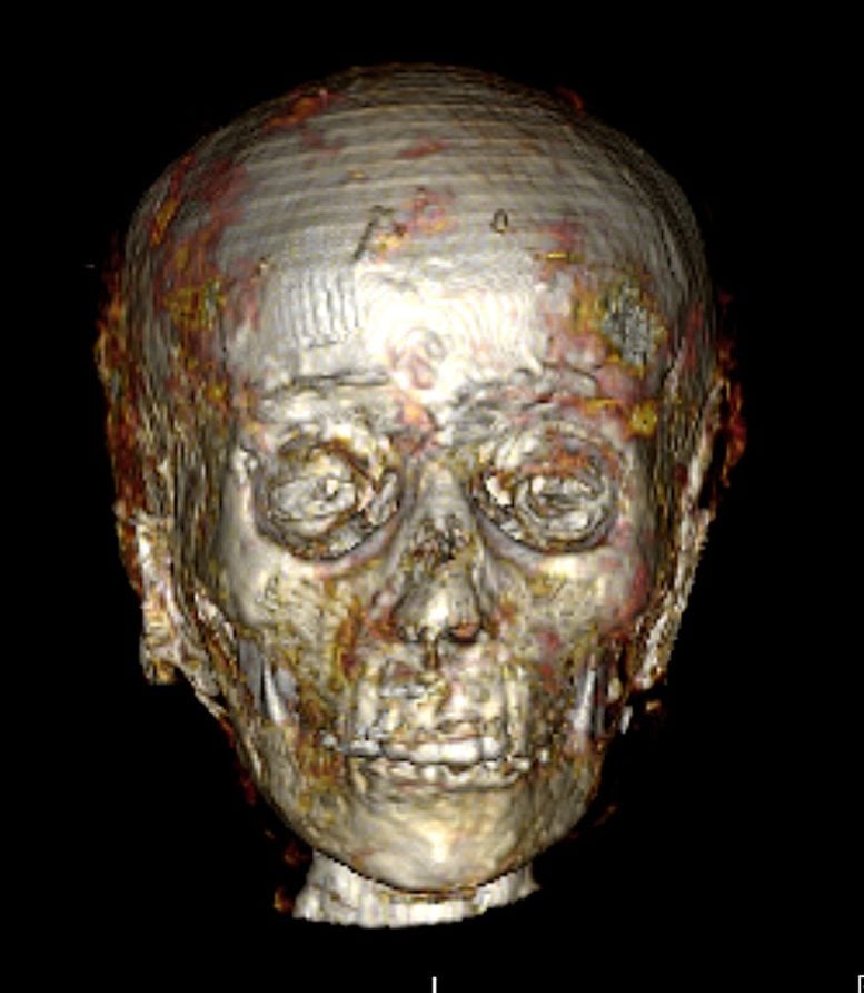 Golden Boy Mummy Skull