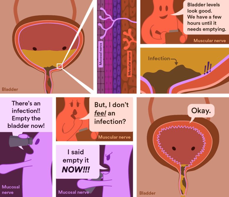 Graphic of the Mucosal Nerve in the Bladder