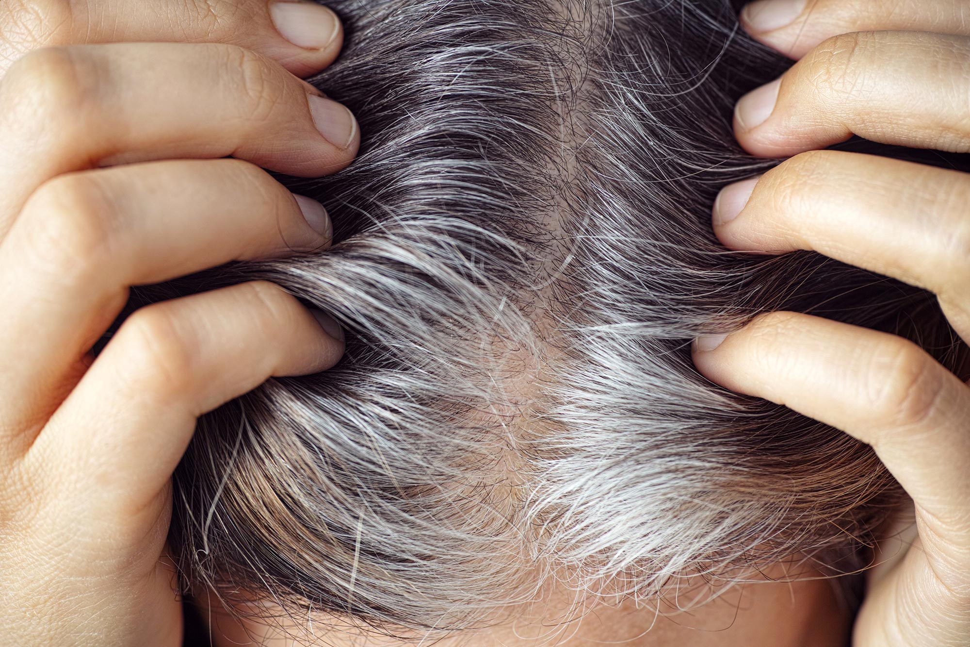 Por que o cabelo fica grisalho?  Pesquisa revela o papel das células-tronco “aprisionadas”