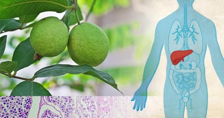 Molekul buah tropis dapat merevolusi pengobatan kanker hati 1 Buah jambu dan ilustrasi hati manusia