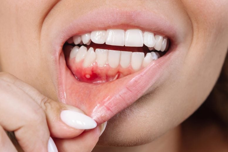This Common Dental Problem Could Threaten Your Brain