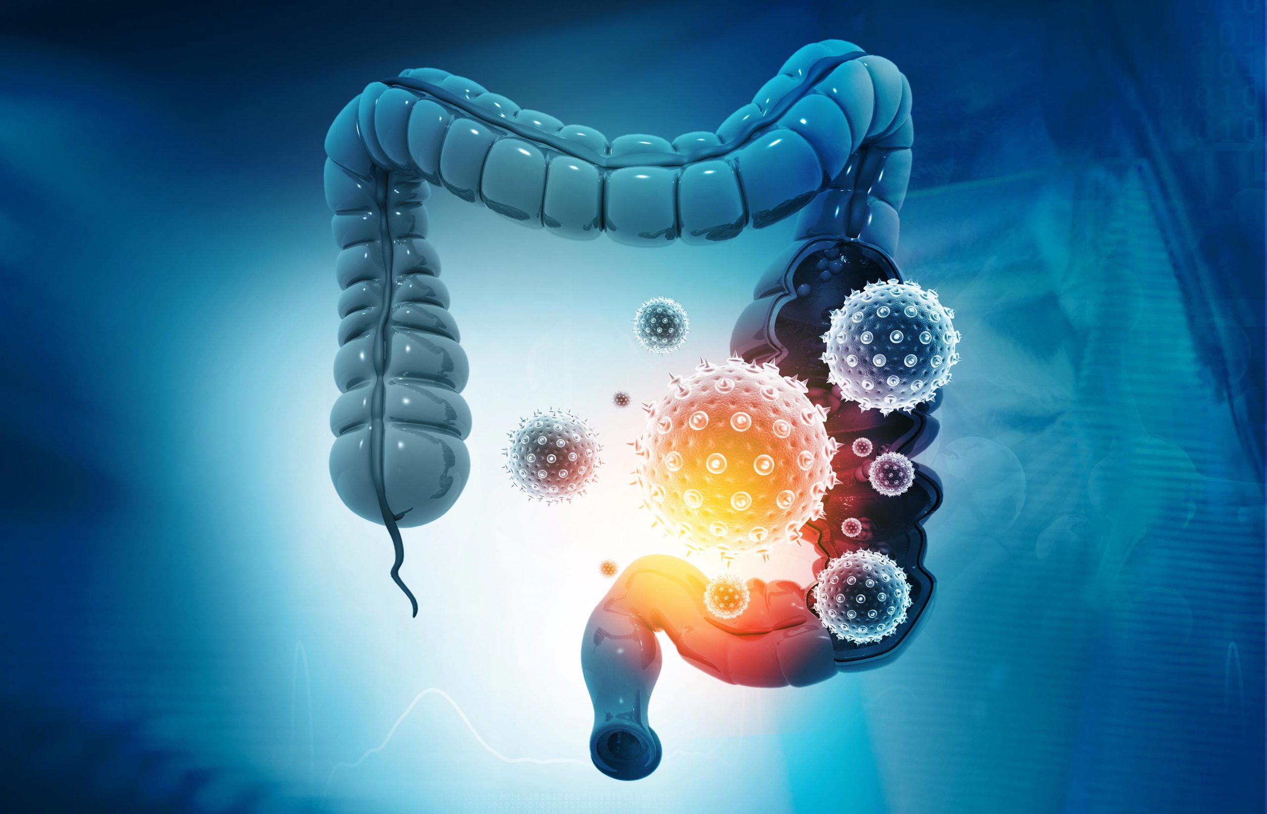 Make-Up of Gut Microbiome May Be Linked to Long Covid Risk