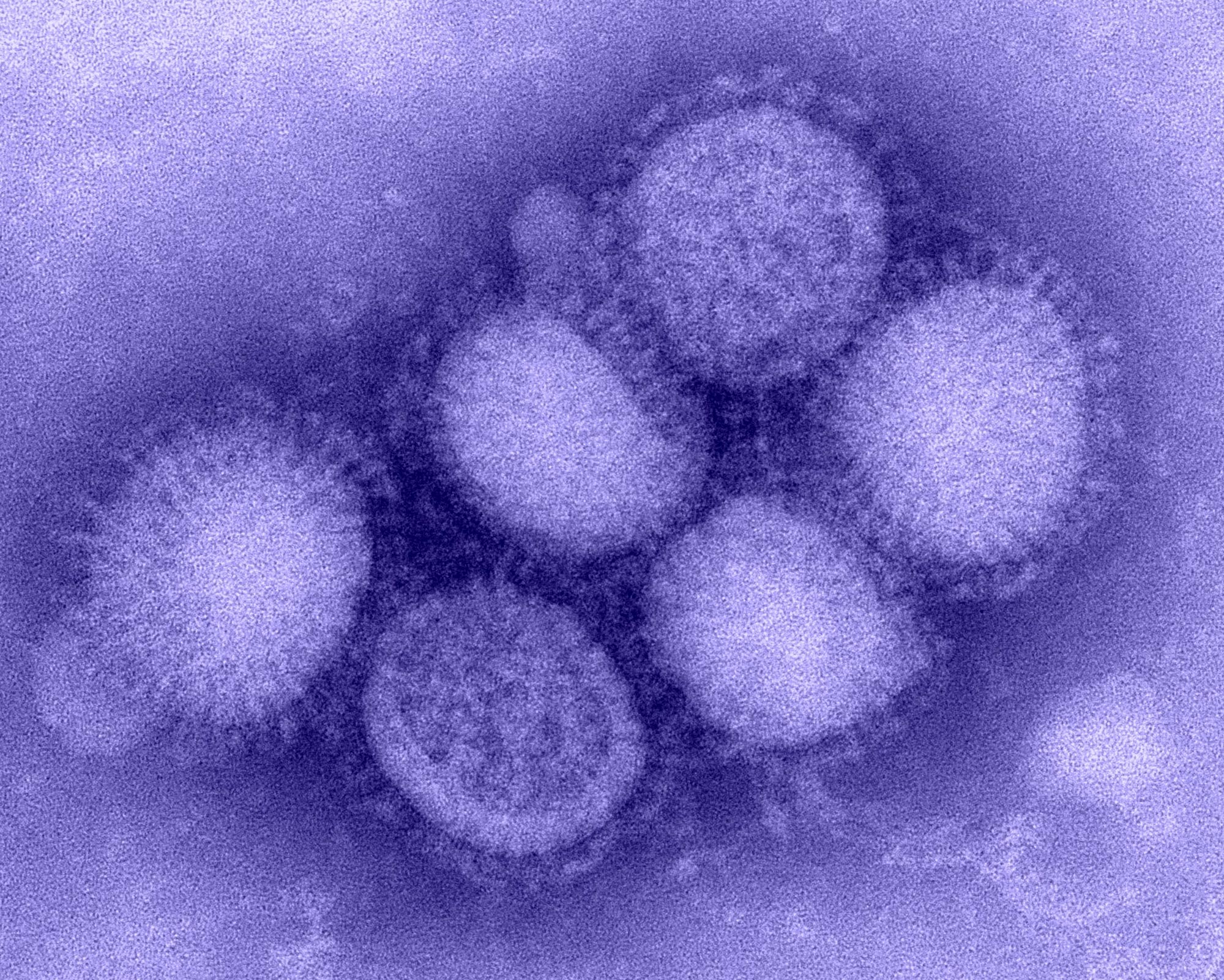 Вирус гриппа группа. Вирус гриппа. Типы вирусов. Вирус гриппа б. Вирус гриппа типа б.