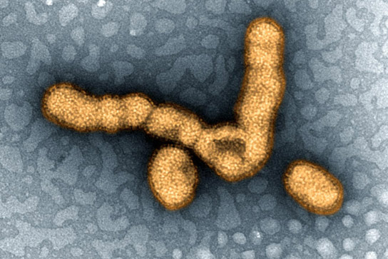 H1N1 Outbreak in India Raises Concern