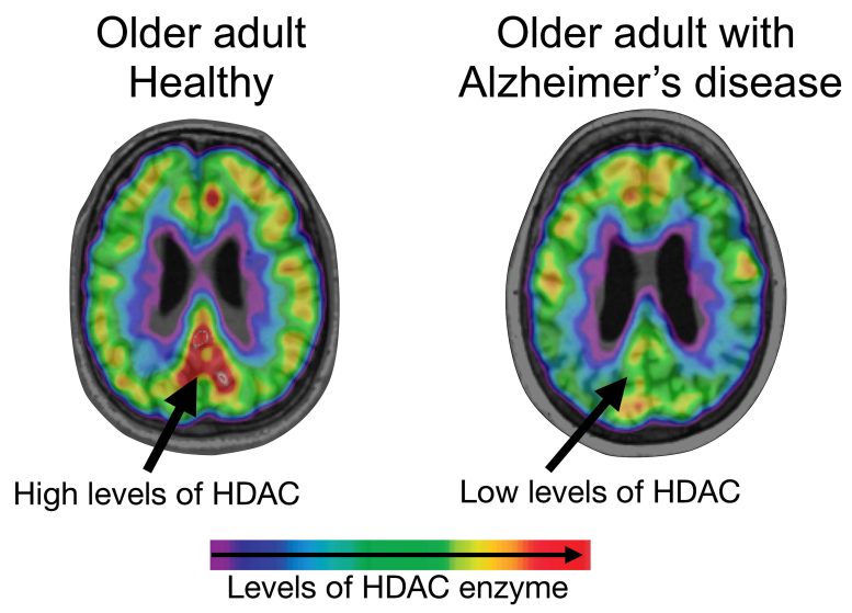 HDAC Levels Brain