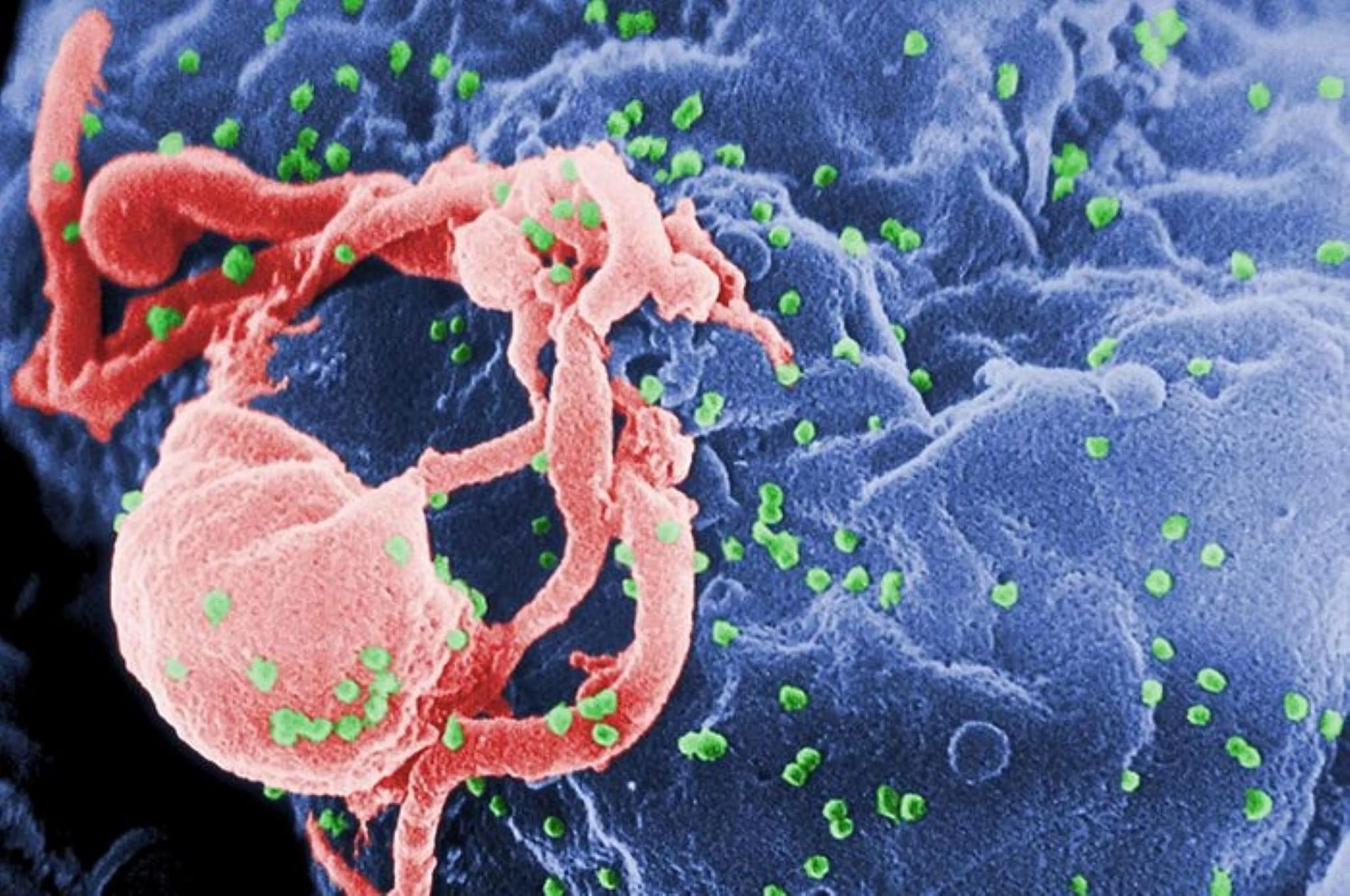 HIV Image