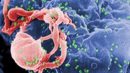 HIV Image