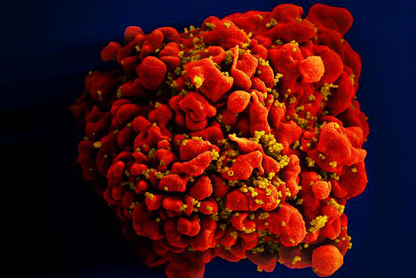 HIV Immune Cell