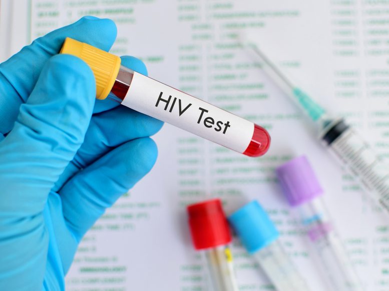 HIV分析