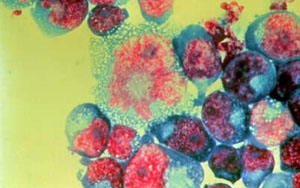 HIV-infected T-cells