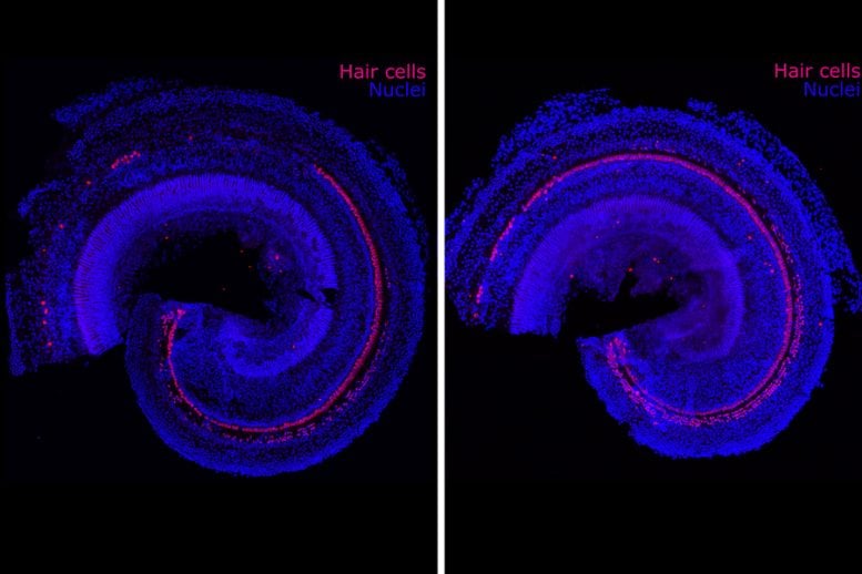 Hair Cells Nuclei, Cellular Regeneration