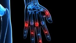 Hand Finger Joint Pain
