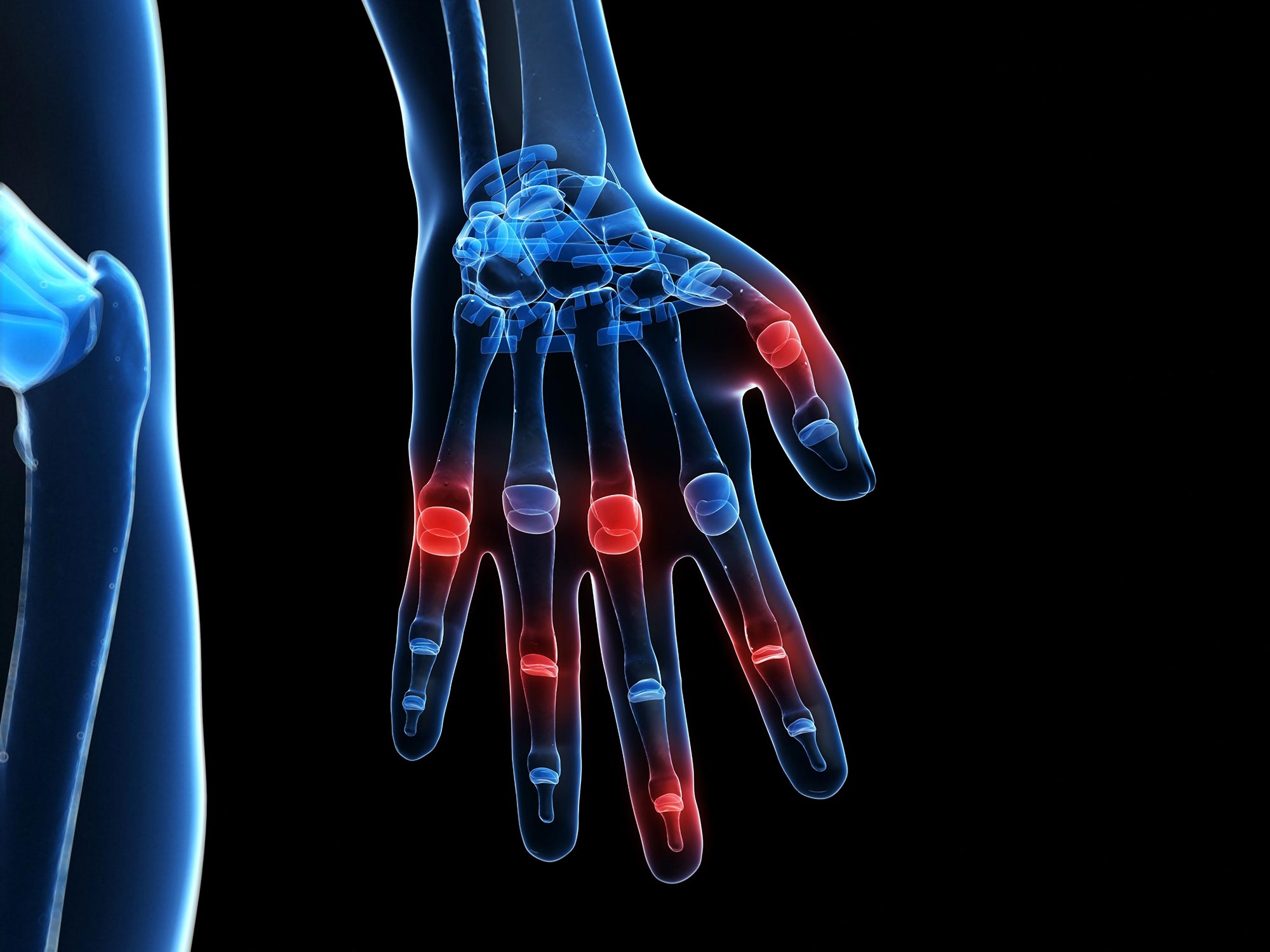 Hand Finger Joint Pain
