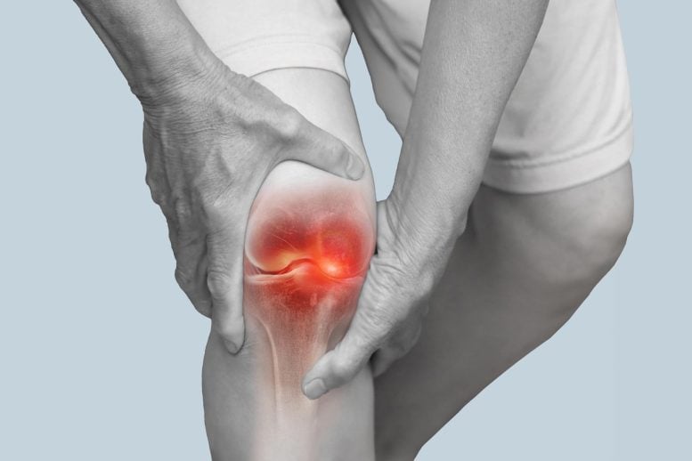 Doctors May Be Overlooking the Real Cause of Persistent Arthritis Pain
