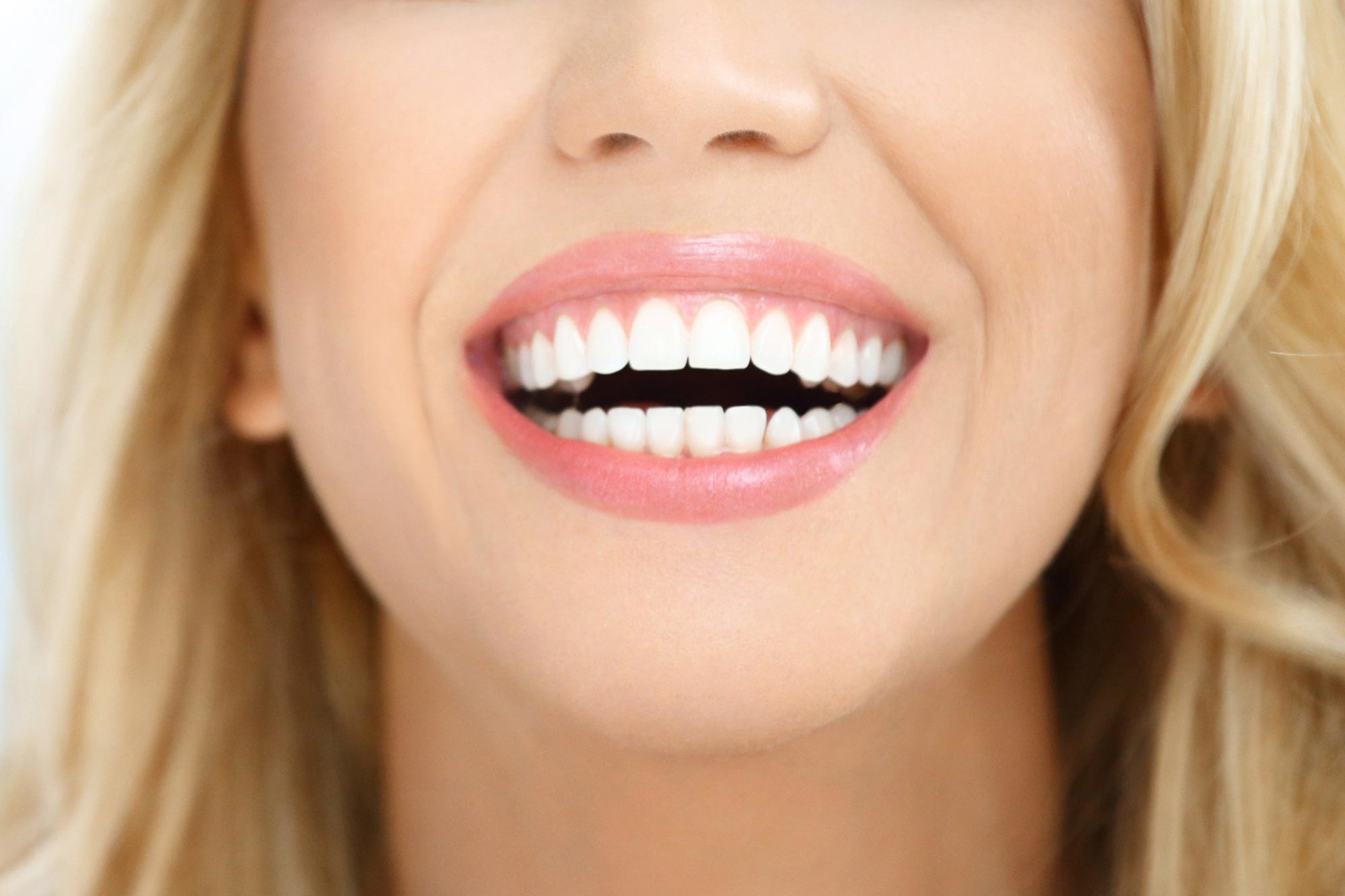 Красивые зубы. Идеальные зубы. Белоснежные зубы. Красивые ровные зубы.