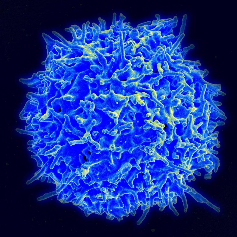 Healthy Human T Cell Scanning Electron Micrograph
