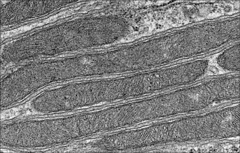 Healthy Mitochondria