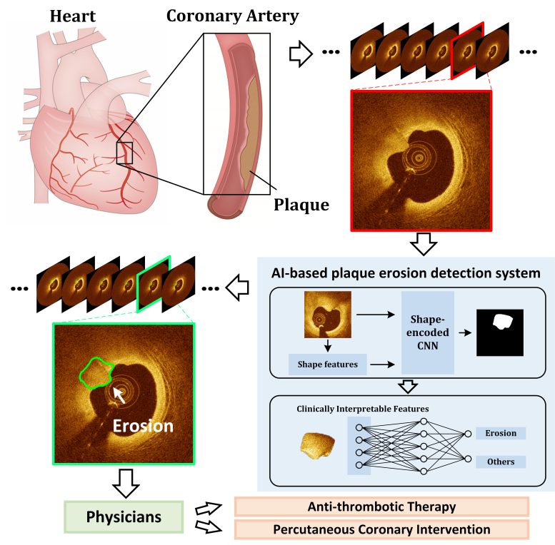 Heart AI Graphic