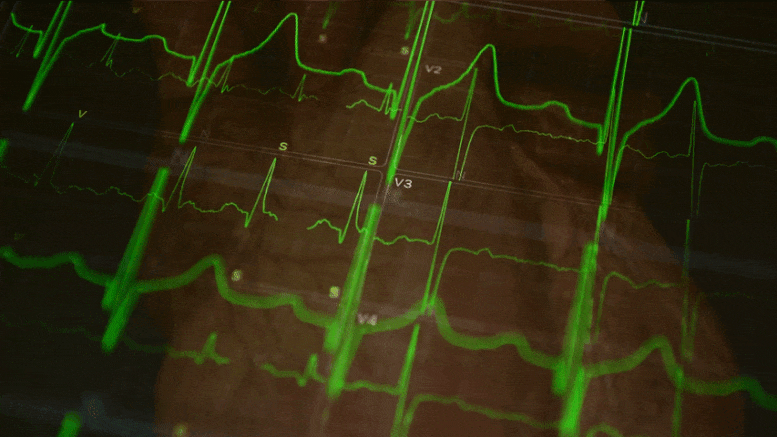 Heart Cardiology Concept