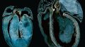 Heart Failure Caused By Energy Production Deficiency