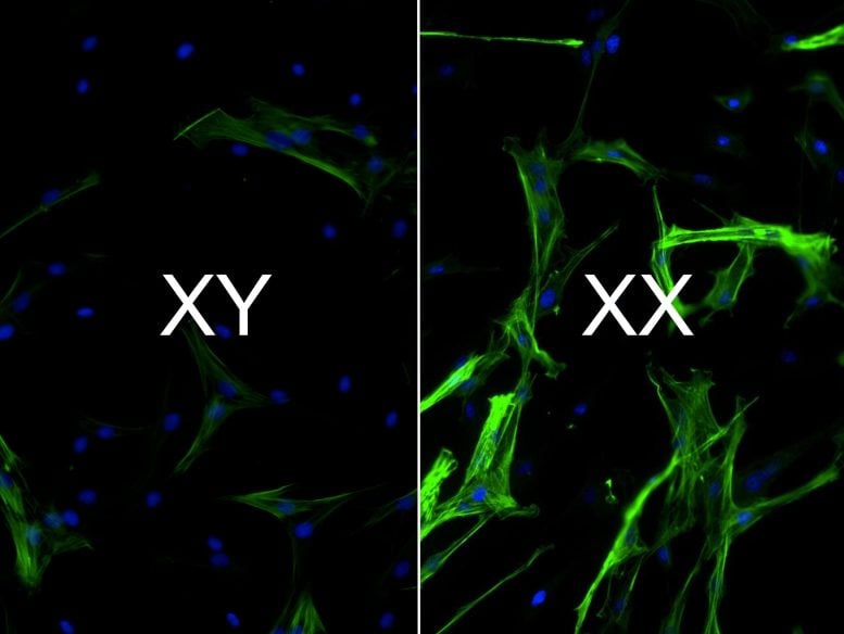 Heart Tissue XX vs XY Chromosomes