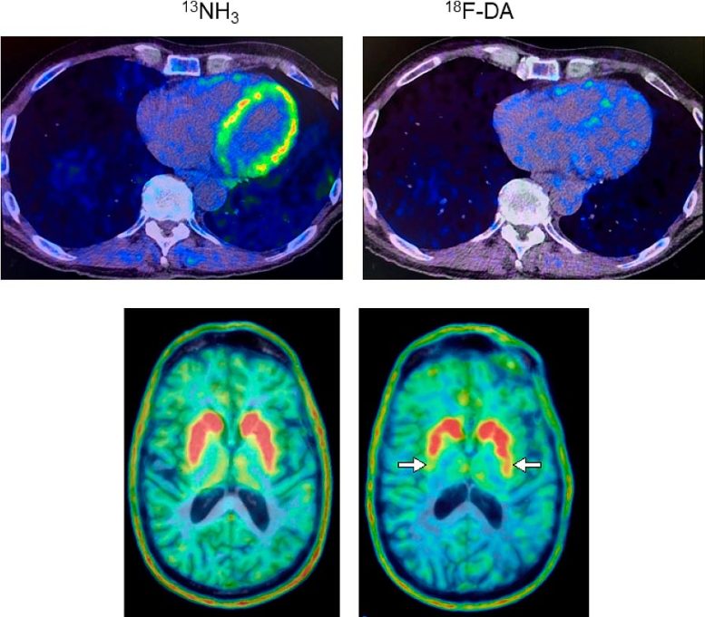Heart and Brain PET Scans