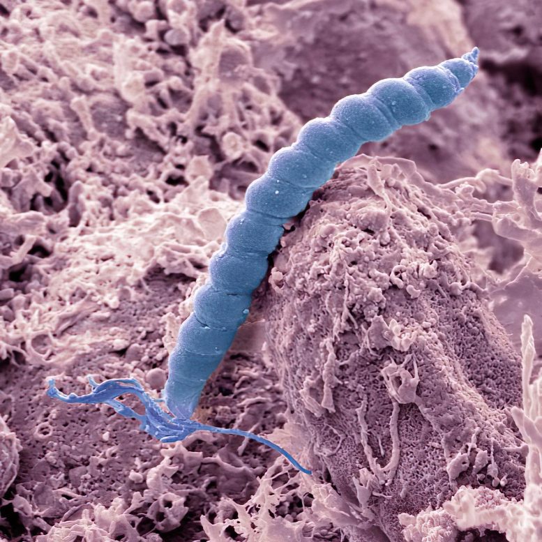 Helicobacter pylori Bacteria Electron Micrograph