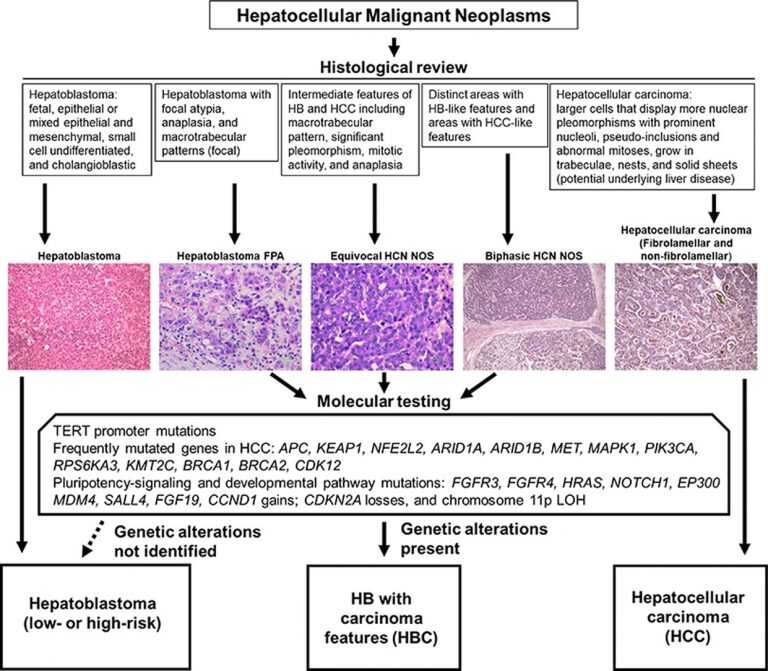 Hepatocellular Malignant Neoplasms Testing Graphic