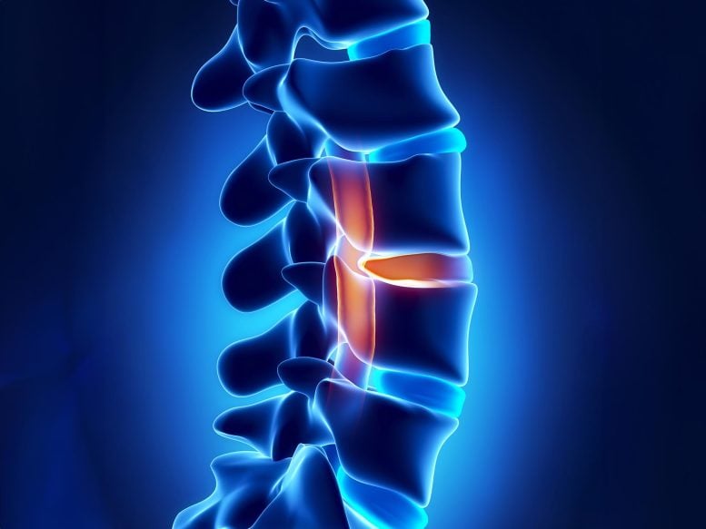 Aging Changes Spinal Cord Injury Recovery in a Surprising Way