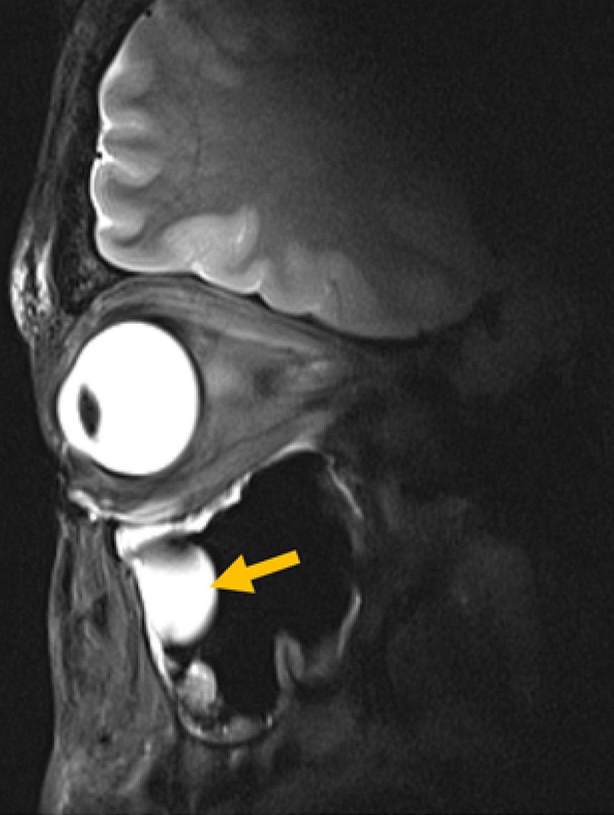 New MRI Breakthrough Captures Stunningly Clear Images of the Eye and Brain