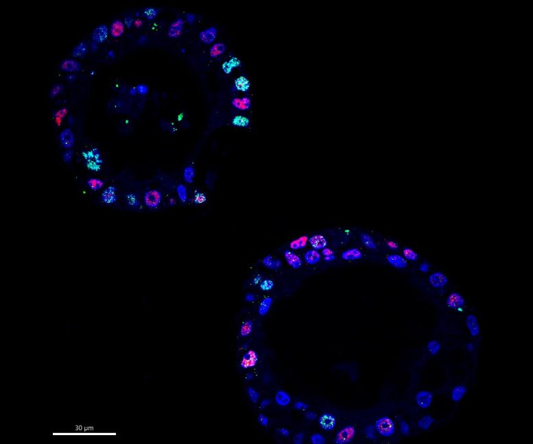 Higher MYC Levels Correlate With Increased DNA Damage in Cancer Cells