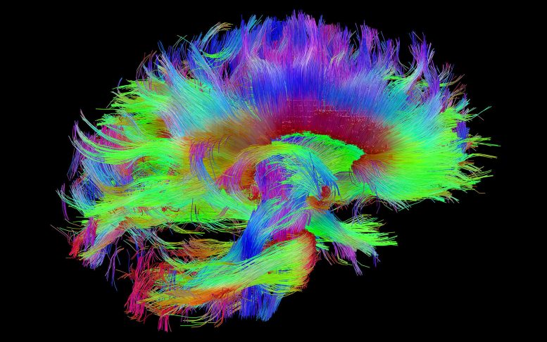 Highly Detailed ‘Wiring Diagram’ of a Human Brain