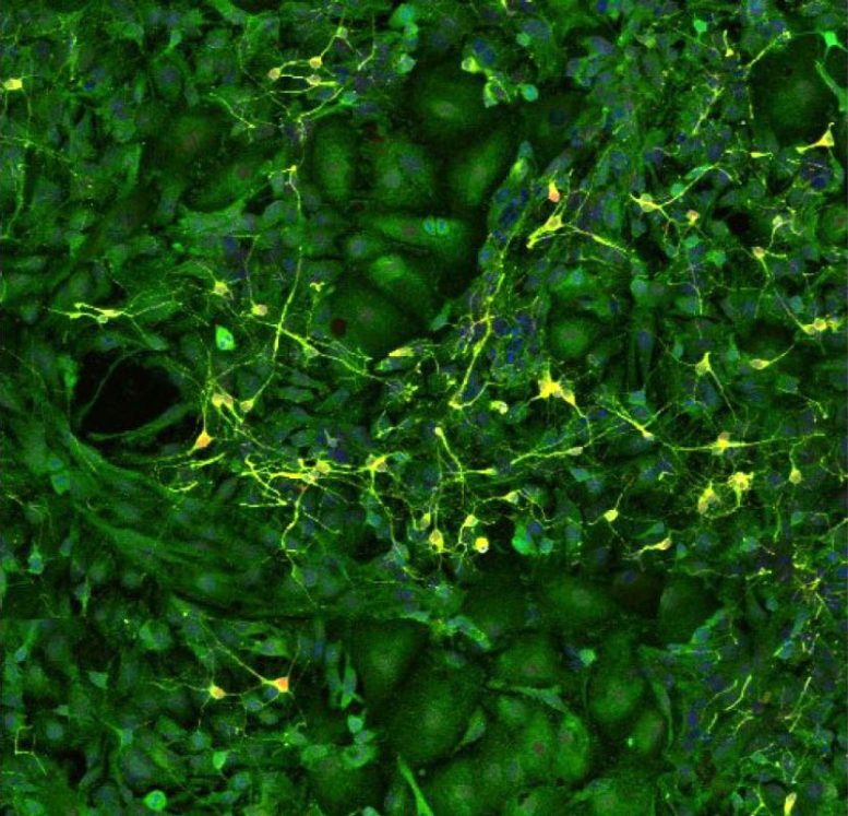 Hippocampal Neurons and Astrocytes