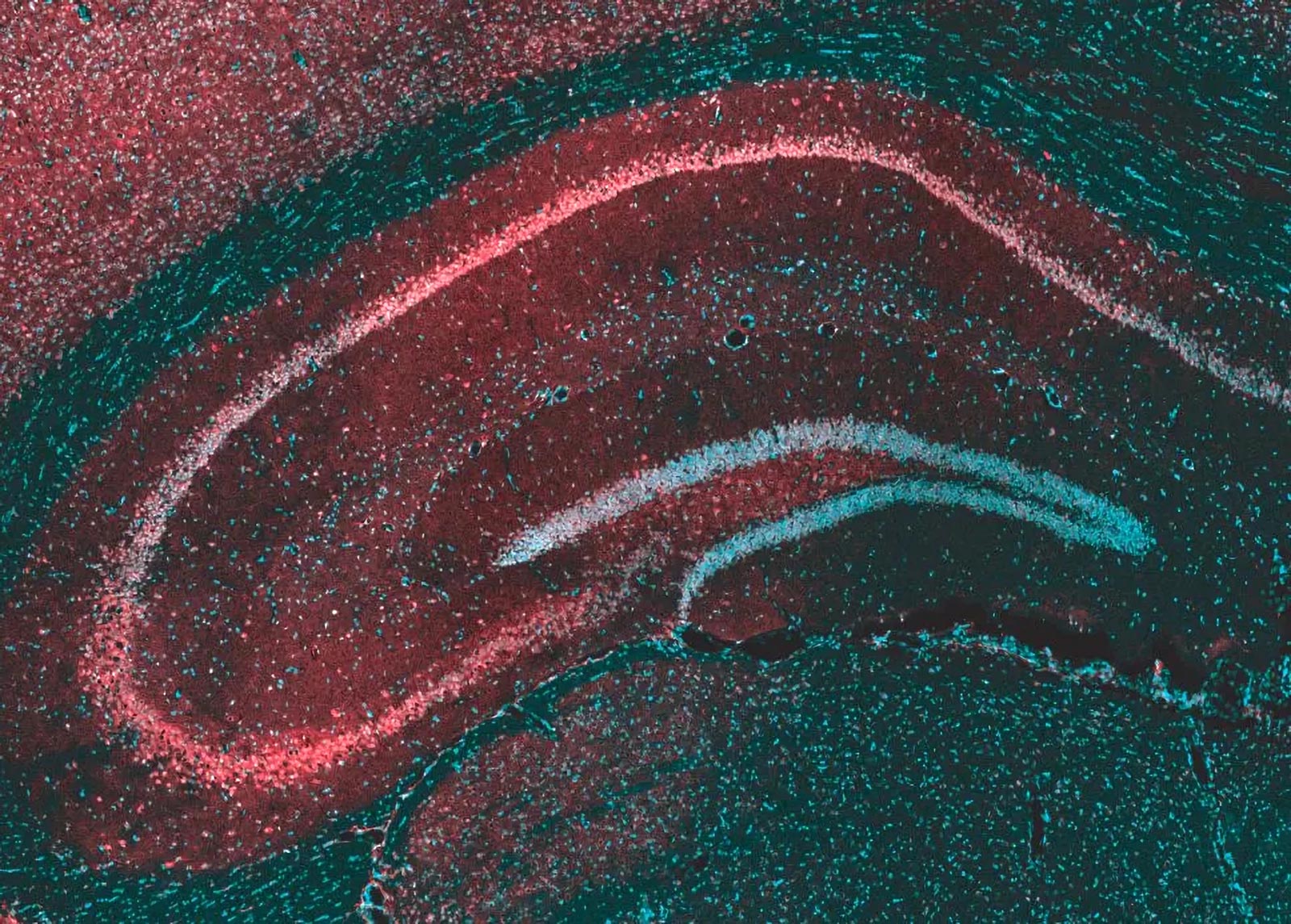 Hippocampus Brain Region Microscope Image
