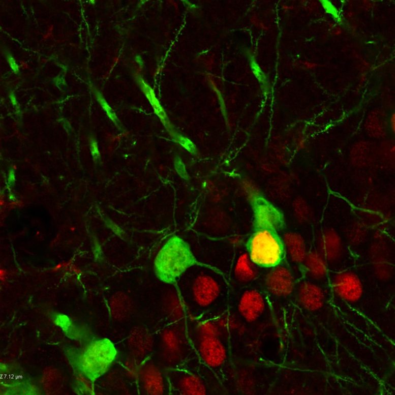 Hippocampus Neurons DeltaFosB