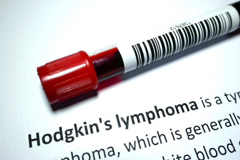 Hodgkin Lymphoma Blood Testing
