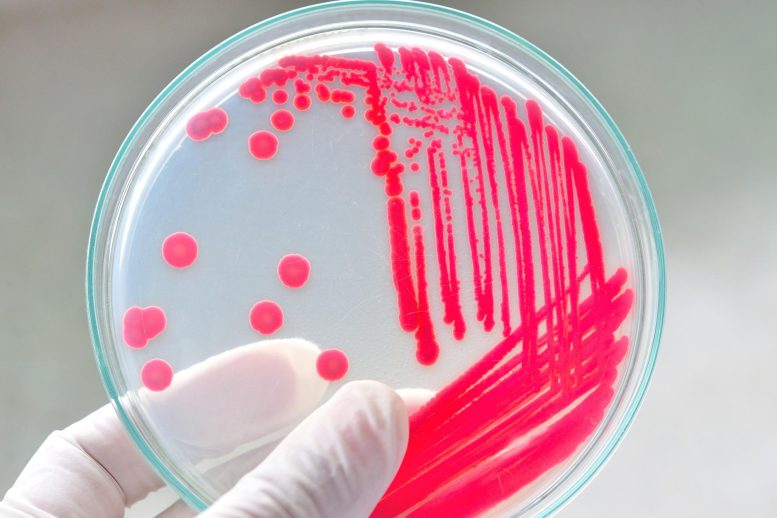 Holding Petri Dish With Bacteria
