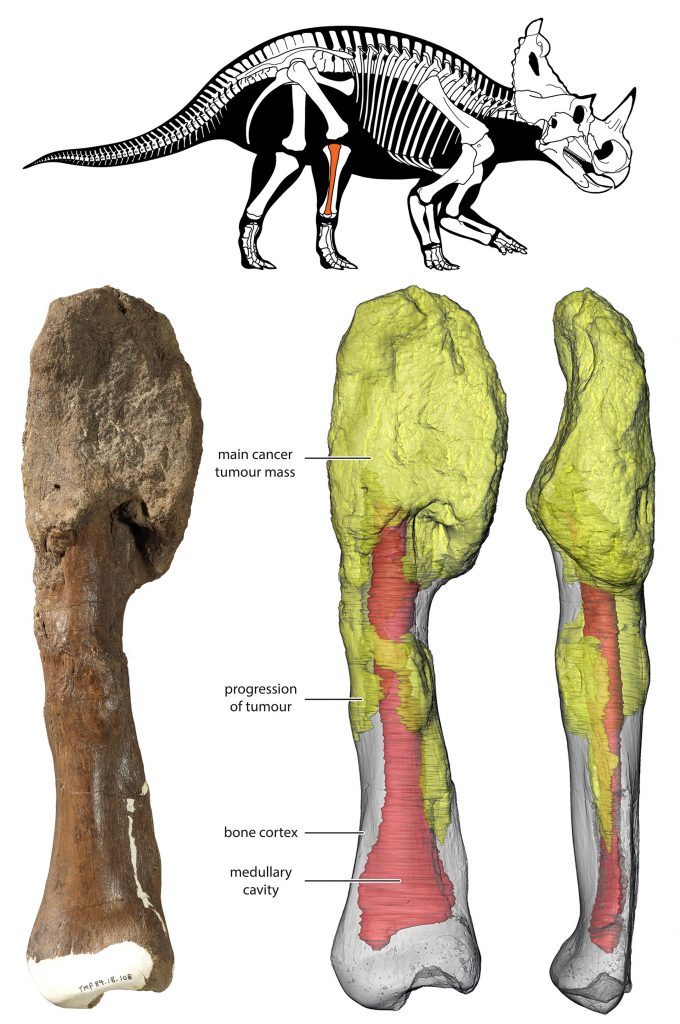 Horned Dinosaur Centrosaurus Apertus Shin Bone With Malignant Bone Cancer