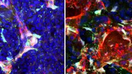 How Stem Cells Act When Stressed Versus When At Rest