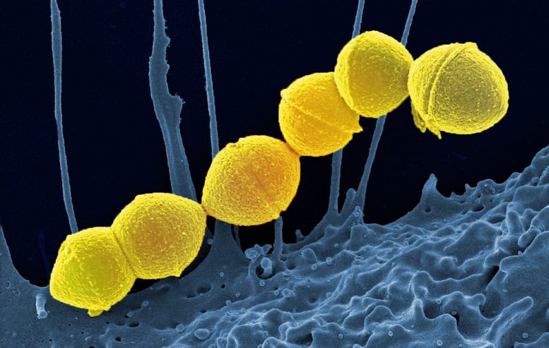 How to Beat Antibiotic-Resistant Superbugs
