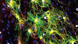 Human Astrocytes Mouse Brain